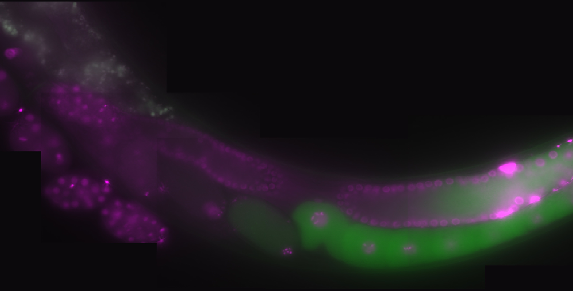 Expression of the RNA-binding protein LIN-41 (green) and DNA (magenta) in the germline of C. elegans