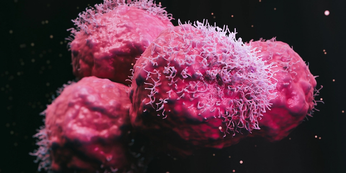 Malignant cancer cells