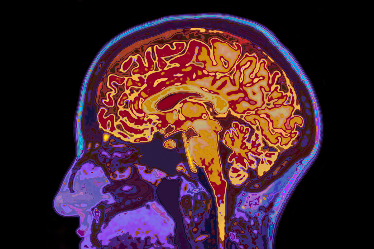 Image of brain 